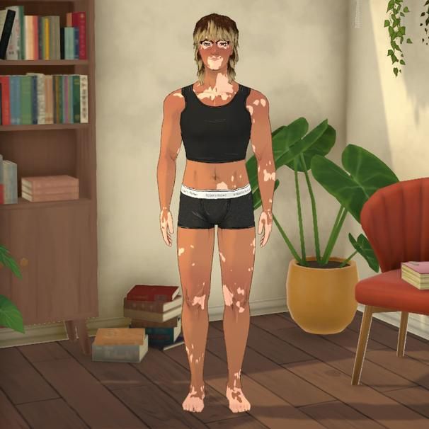 Vitiligo Unlocked. image 3