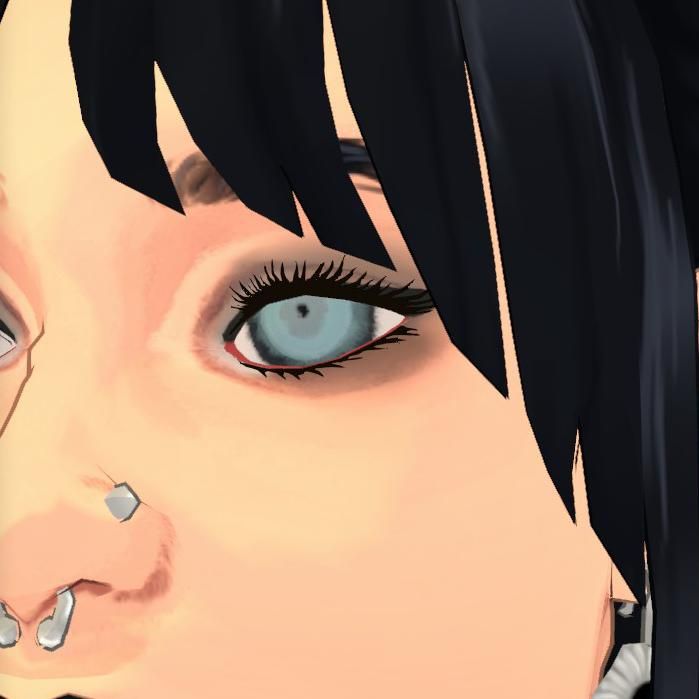 Sylvie's Eye Replacement: image 6