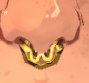 Septum Pack [Rikalix] image 1