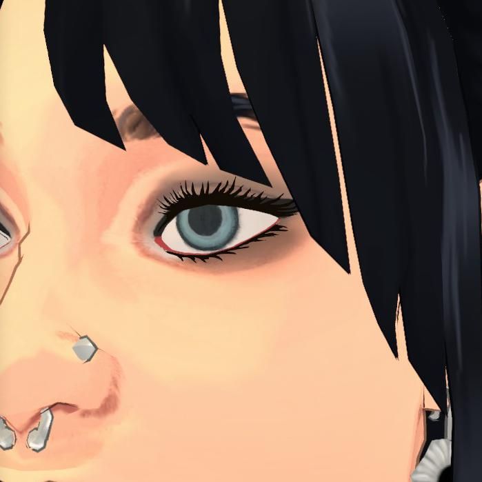 Sylvie's Eye Replacement: image 8