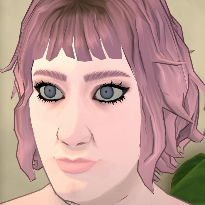 Sylvie's Eye Replacement: image 3