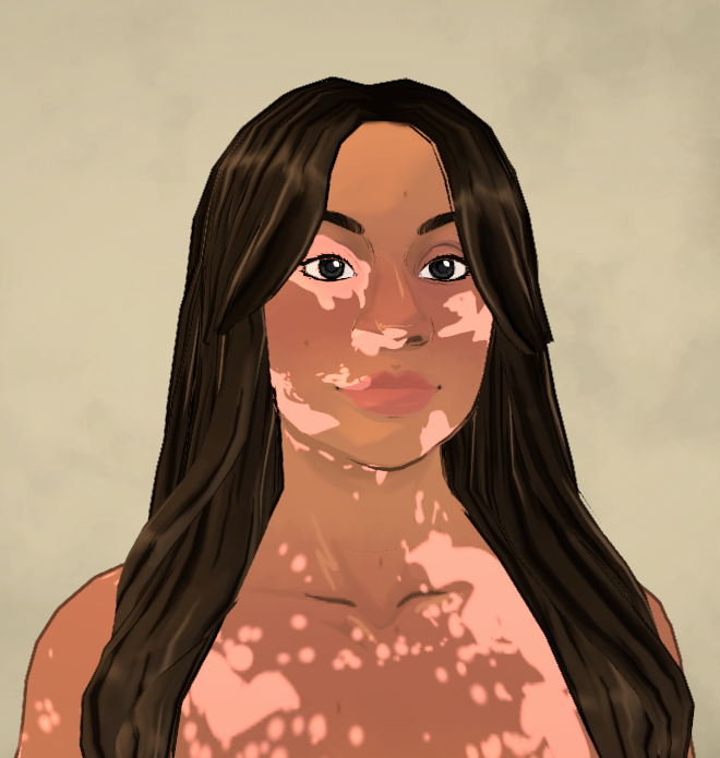 Vitiligo [Rikalix] image 2