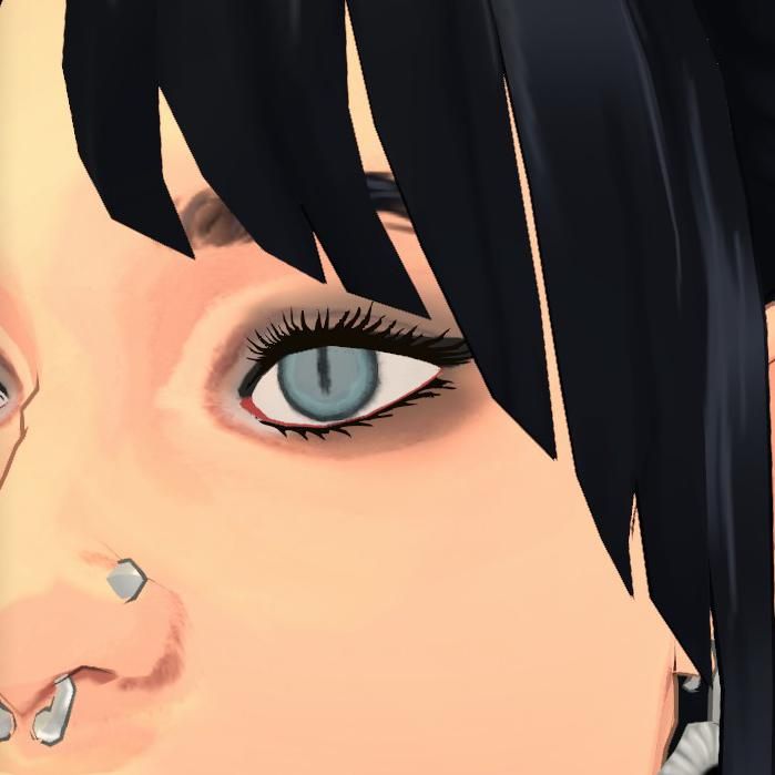 Sylvie's Eye Replacement: image 7