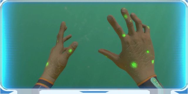 Bacterial Infection Report